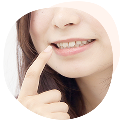 審美治療 銀歯の詰め物が目立つ 白く美しい歯になりたい